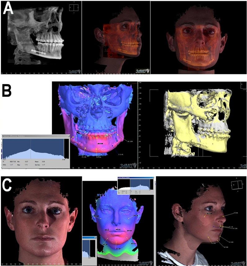 An external file that holds a picture, illustration, etc., usually as some form of binary object. The name of referred object is rmmj-3-2-e0012_Figure8.jpg